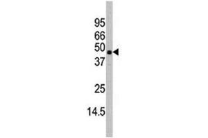 Western blot analysis of MAPK11 antibody and mouse heart tissue lysate (MAPK11 antibody  (AA 334-359))