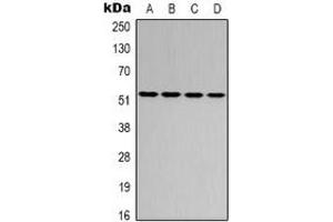Western blot analysis of ATF2 expression in Hela (A), MCF7 (B), SP20 (C), rat brain (D) whole cell lysates. (ATF2 antibody)