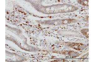 Immunoperoxidase of monoclonal antibody to CDH18 on formalin-fixed paraffin-embedded human small Intestine. (CDH18 antibody  (AA 467-576))