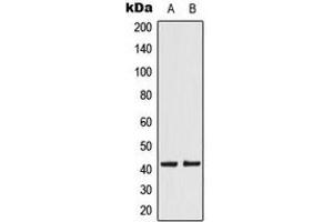 Western blot analysis of KCNK15 expression in JEG3 (A), HeLa (B) whole cell lysates. (KCNK15 antibody  (C-Term))