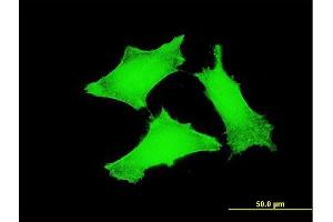 Immunofluorescence of monoclonal antibody to TCL1A on HeLa cell. (TCL1A antibody  (AA 61-114))