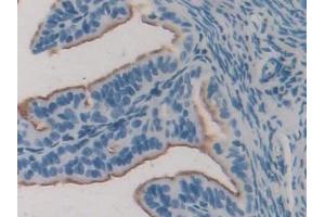 Detection of ERa in Mouse Oviduct Tissue using Polyclonal Antibody to Estrogen Receptor Alpha (ERa) (Estrogen Receptor alpha antibody  (AA 233-483))