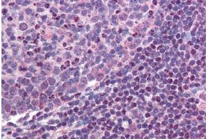 Colon, lymphoid follicle (MALT1 antibody  (AA 43-57))