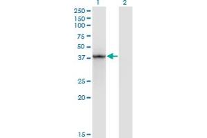 Western Blot analysis of STAT5B expression in transfected 293T cell line by STAT5B monoclonal antibody (M01), clone 1A1. (STAT5B antibody  (AA 1-390))