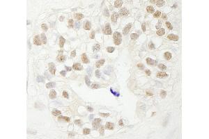 Immunohistochemistry (IHC) image for anti-F-Box and WD Repeat Domain Containing 7 (FBXW7) (AA 50-100) antibody (ABIN7448563)