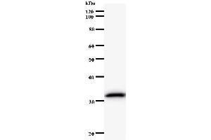 Western Blotting (WB) image for anti-Endonuclease 8-like 2 (NEIL2) antibody (ABIN933141) (NEIL2 antibody)