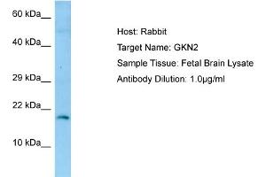 Western Blotting (WB) image for anti-Gastrokine 2 (GKN2) (N-Term) antibody (ABIN2790149) (Gastrokine 2 antibody  (N-Term))