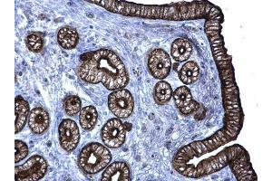 IHC-P Image Cytokeratin 6 antibody detects Cytokeratin 6 protein at membrane on mouse cervix by immunohistochemical analysis. (KRT6A antibody)