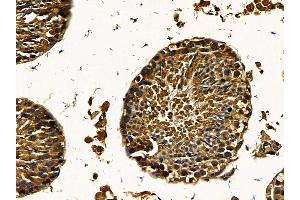 ABIN7095560 and ABIN7099617 at 1/100 staining mouse testis tissue by IHC-P. (ARPIN antibody)