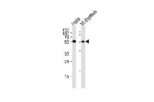Chk1 Antibody  (ABIN388983 and ABIN2839219) western blot analysis in Hela cell line and mouse thymus tissue lysates (35 μg/lane). (CHEK1 antibody  (AA 258-287))