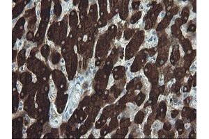 Immunohistochemistry (IHC) image for anti-Formiminotransferase Cyclodeaminase (FTCD) antibody (ABIN1496377) (FTCD antibody)