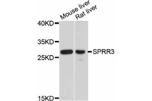 Western blot analysis of extracts of various cell lines, using SPRR3 antibody.