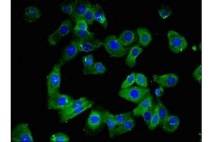 Immunofluorescent analysis of HepG2 cells using ABIN7147875 at dilution of 1:100 and Alexa Fluor 488-congugated AffiniPure Goat Anti-Rabbit IgG(H+L) (Claudin 1 antibody  (AA 185-224))