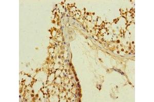 Immunohistochemistry of paraffin-embedded human testis tissue using ABIN7147376 at dilution of 1:100 (PLK1S1 antibody  (AA 1-240))