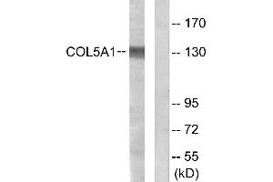 Immunohistochemistry analysis of paraffin-embedded human heart tissue using Collagen V α1 antibody.