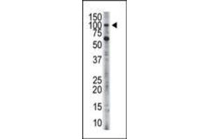 The anti-HK3 Pab (ABIN392753 and ABIN2842205) is used in Western blot to detect HK3 in HL-60 cell lysate. (HK3 antibody  (C-Term))