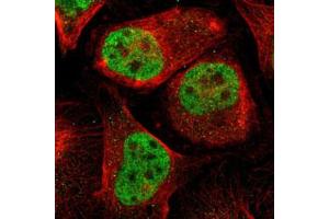 Immunofluorescent staining of U-2 OS with MEF2D polyclonal antibody  (Green) shows positivity in nucleus but excluded from the nucleoli. (MEF2D antibody)