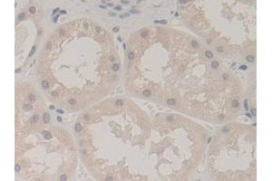 Immunohistochemistry (IHC) image for anti-Ubiquitin A-52 Residue Ribosomal Protein Fusion Product 1 (UBA52) (AA 1-128) antibody (ABIN7441190)