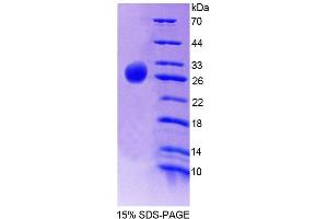 SDS-PAGE analysis of Human FLRT2 Protein. (FLRT2 Protein)