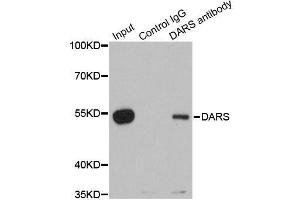 Immunoprecipitation (IP) image for anti-Aspartyl-tRNA Synthetase (DARS) (AA 222-501) antibody (ABIN6139407)