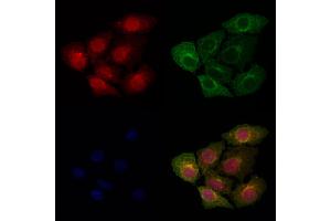 ABIN6264379 and ABIN6277166 staining Hela cells by IF/ICC.