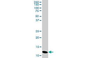 PFN2 monoclonal antibody (M05), clone 6G3. (PFN2 antibody  (AA 41-140))