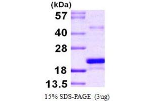 SDS-PAGE (SDS) image for Methionine Sulfoxide Reductase B3 (MSRB3) (AA 21-185) protein (His tag) (ABIN667884) (MSRB3 Protein (AA 21-185) (His tag))