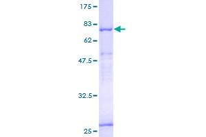 Image no. 1 for Integrin alpha FG-GAP Repeat Containing 2 (ITFG2) (AA 1-447) protein (GST tag) (ABIN1308157) (ITFG2 Protein (AA 1-447) (GST tag))