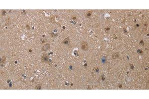 Immunohistochemistry of paraffin-embedded Human brain tissue using MGLL Polyclonal Antibody at dilution 1:40 (MGLL antibody)