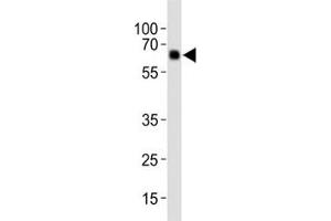 Western blot analysis of lysate from human placenta tissue, using Park6/ PINK1 antibody diluted at 1:1000. (PINK1 antibody  (AA 118-147))