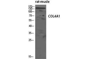 Western Blot (WB) analysis of specific cells using COL4A1 Polyclonal Antibody. (COL4A1 antibody  (N-Term))
