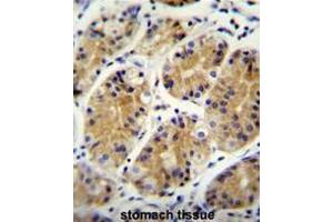 MGC24975 Antibody (C-term) immunohistochemistry analysis in formalin fixed and paraffin embedded human stomach tissue followed by peroxidase conjugation of the secondary antibody and DAB staining. (PRR22 antibody  (C-Term))