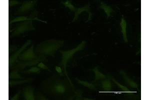 Immunofluorescence of monoclonal antibody to ATM on HeLa cell. (ATM antibody  (AA 1-138))