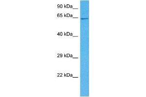 Host:  Mouse  Target Name:  SMAD4  Sample Tissue:  Mouse Kidney  Antibody Dilution:  1ug/ml (SMAD4 antibody  (N-Term))