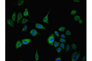 Immunofluorescent analysis of A549 cells using ABIN7170610 at dilution of 1:100 and Alexa Fluor 488-congugated AffiniPure Goat Anti-Rabbit IgG(H+L) (SPIN4 antibody  (AA 1-249))