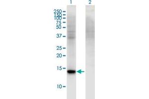 Western Blot analysis of RBP7 expression in transfected 293T cell line by RBP7 monoclonal antibody (M01), clone 4F4. (RBP7 antibody  (AA 35-134))