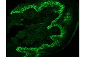 Immunohistochemistry on frozen section of swine skin showing basal cell staining (KRT14 antibody)