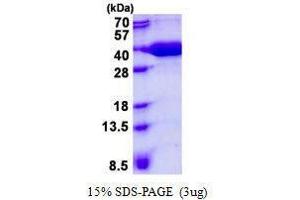 Figure annotation denotes ug of protein loaded and % gel used. (VBP1 Protein)