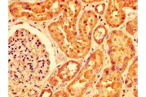 IHC image of ABIN7163704 diluted at 1:200 and staining in paraffin-embedded human kidney tissue performed on a Leica BondTM system. (PLXNB1 antibody  (AA 664-837))