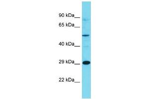 Western Blotting (WB) image for anti-Olfactory Receptor, Family 7, Subfamily E, Member 86 Pseudogene (OR7E86P) (C-Term) antibody (ABIN2791455) (OR7E86P antibody  (C-Term))