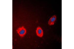 Immunofluorescent analysis of Cytokeratin 17 staining in HeLa cells. (KRT17 antibody  (C-Term))
