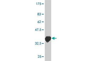 Western Blot detection against Immunogen (36. (DYRK2 antibody  (AA 1-100))