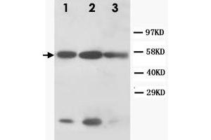Western Blot analysis of KRT8 expression from cell extracts with KRT8 polyclonal antibody . (KRT8 antibody  (N-Term))