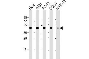Lane 1: HeLa Cell lysates, Lane 2: A431 Cell lysates, Lane 3: PC-12 Cell lysates, Lane 4: COS-7 Cell lysates, Lane 5: NIH/3T3 Cell lysates, probed with MP2K1 (1678CT373. (MEK1 antibody)