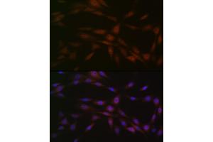 Immunofluorescence (IF) image for anti-Casein Kinase 2, beta (CSNK2B) antibody (ABIN1680593)