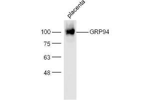 Mouse placenta lysates probed with Rabbit Anti-GRP94 Polyclonal Antibody, Unconjugated  at 1:500 for 90 min at 37˚C (GRP94 antibody  (AA 554-650))