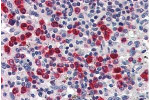 Human Spleen (formalin-fixed, paraffin-embedded) stained with LCN2 antibody ABIN337222 at 2. (Lipocalin 2 antibody  (AA 60-72))
