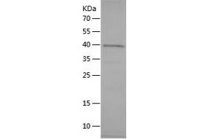 Western Blotting (WB) image for Glycophorin A (GYPA) (AA 20-150) protein (His-IF2DI Tag) (ABIN7123165) (CD235a/GYPA Protein (AA 20-150) (His-IF2DI Tag))