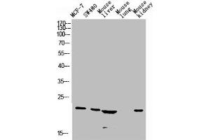 Western blot analysis of Jurkat U937 Raji mouse-eye lysate, antibody was diluted at 1000. (CGRP antibody  (AA 80-141))