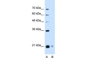 Western Blotting (WB) image for anti-Placenta-Specific 1-Like (PLAC1L) antibody (ABIN2463114) (PLAC1L antibody)